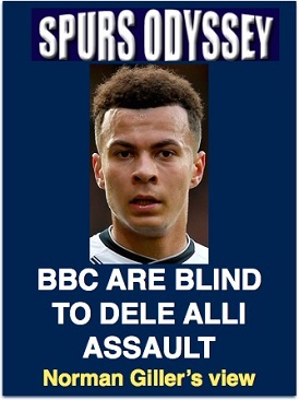BBC are blind to Dele Alli assault
